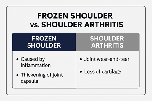 Frozen Shoulder Vs. Shoulder Arthritis