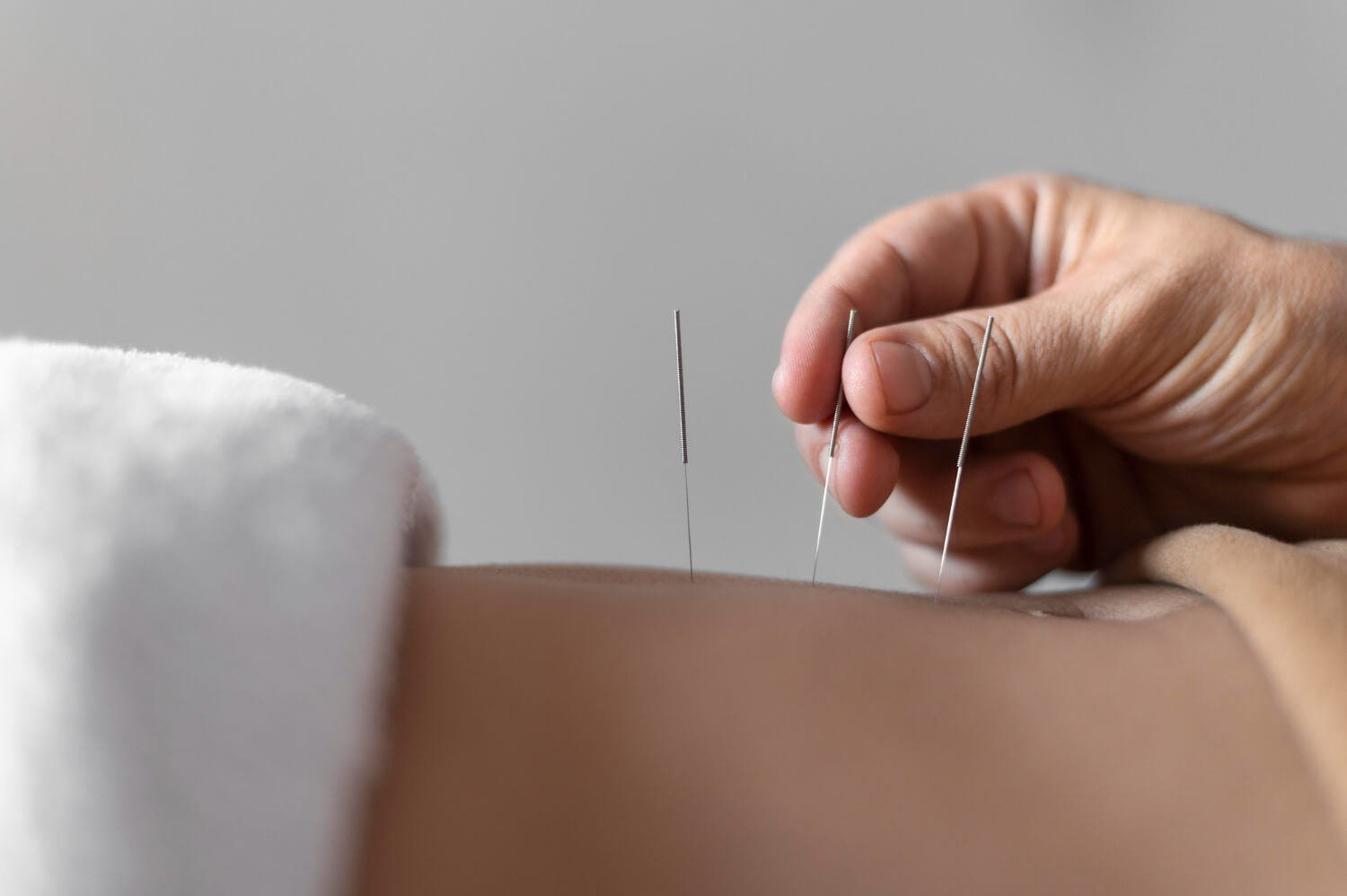 is Acupuncture safe?