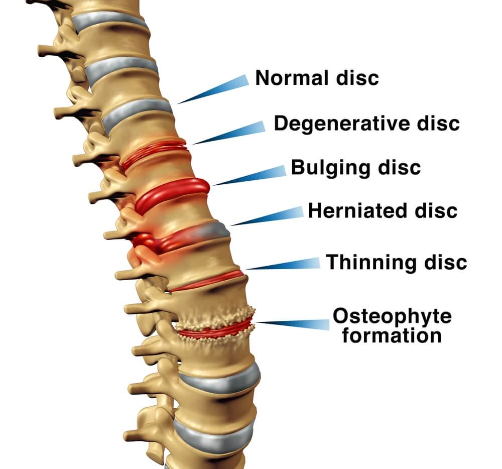 Sports Physiotherapy Norwest