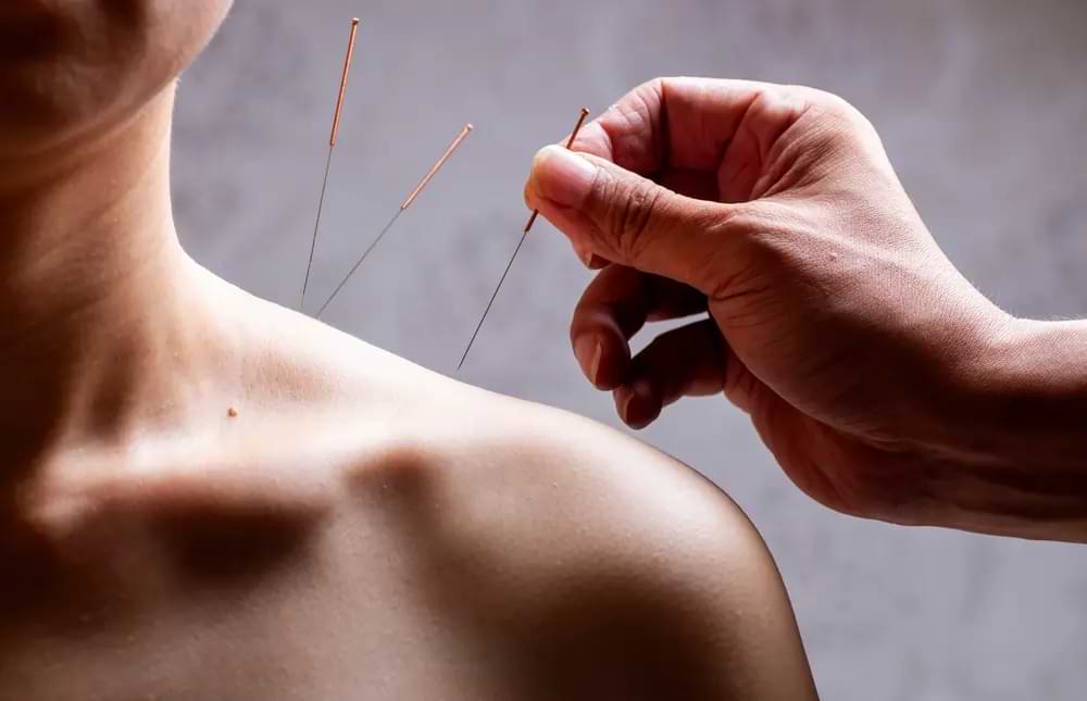 What Conditions Are Treated with Acupuncture